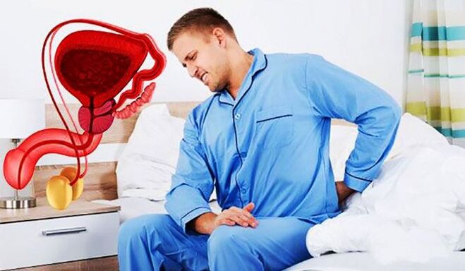 bolečine v spodnjem delu hrbta zaradi prostatitisa