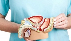 kako zdraviti prostatitis pri moških