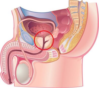 Lokacija prostate pri moških