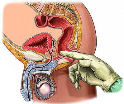 Pregled prostate s prsti