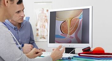 diagnosticiranje prostatitisa pri moškem