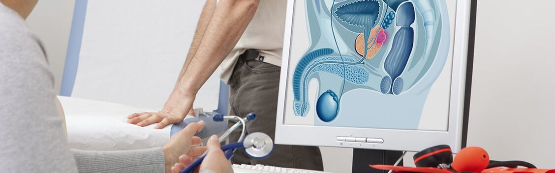 diagnosticiranje in zdravljenje prostatitisa